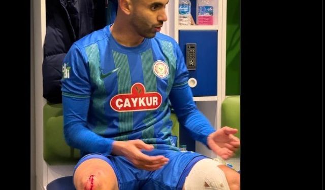 Çaykur Rizespor, Rachid Ghezzal’ın darbe alan ayağının fotoğrafını paylaştı